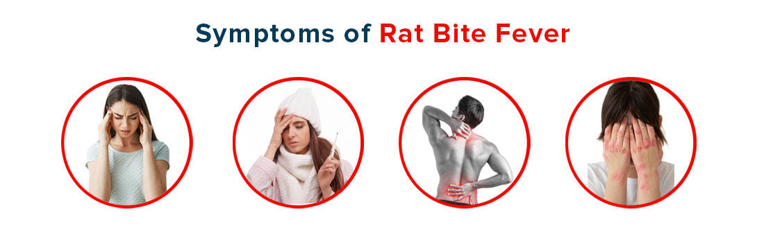 Symptoms of Rat Bite Fever